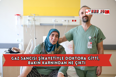 Gaz Sancısı Şikayetiyle Doktora Gitti,  Bakın Karnından Ne Çıktı