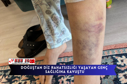 Doğuştan Diz Rahatsızlığı Yaşayan Genç Sağlığına Kavuştu