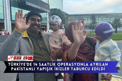 Türkiye'de 14 Saatlik Operasyonla Ayrılan Pakistanlı Yapışık İkizler Taburcu Edildi